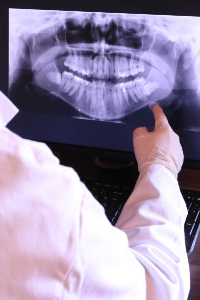 Best Emergency Root Canal Treatment in Brookings, SD