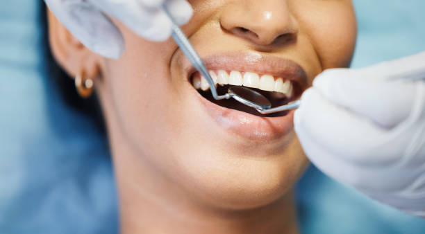 Best Emergency Root Canal Treatment in Brookings, SD